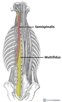musculo semiespinal e multifidos musculo semiespinal e multifidos